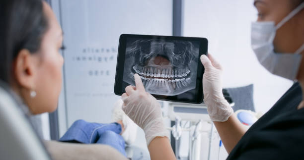 Licensed Teeth Whitening service in Watertown, SD - Smile Center Dentistry